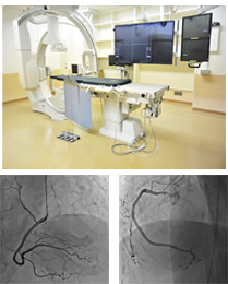 心血管造影検査画像