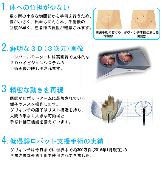 ダヴィンチ特長の画像